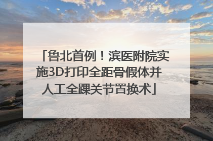 鲁北首例！滨医附院实施3D打印全距骨假体并人工全踝关节置换术
